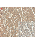 Immunohistochemical staining of human tissue using anti-ST2 (human), mAb (ST33868) (Prod. No. AG-20A-0044) at 1:100 dilution. <br />A. Immunoperoxidase staining (cytoplasmic) of formalin-fixed, paraffin-embedded human heart (100x, brown colour). <br />B. 