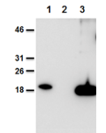 Mouse and human IL-38 is detected using anti-IL-38, mAb (Nhat-1) (AG-20B-0070).<br /><b>Method:</b> Recombinant mouse IL-38 (AG-40B-0101) (lane 1), cell extracts from HEK 293 cells mock-transfected (lane 2) or transfected with human IL-38 (lane 3) were se