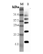 Western blot analysis using anti-RELM-&alpha; (rat), pAb (Prod. No. AG-25A-0011) at 1:5'000 dilution.<br />
1: Rat RELM-&alpha;.