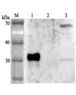 Western blot analysis using anti-ANGPTL4 (human), pAb (Prod. No. AG-25A-0038) at 1:2'000 dilution.<br />
1: Human ANGPTL4 (FLAG<sup>®</sup>-tagged).<br />
2: Human ANGPTL6 (FLAG<sup>®</sup>-tagged).<br />
3: HepG2 cell lysate.