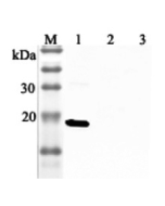 Western blot analysis using anti-IL-33 (human), pAb (Prod. No. AG-25A-0045) at 1:2'000 dilution.<br />
1: Human IL-33 (His-tagged).<br />
2: Unrelated protein (His-tagged) (negative control).<br />
2: Human single chain IL-23 (FLAG<sup>®</sup>-tagged).