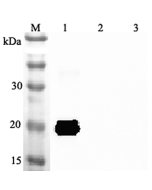 Western blot analysis using anti-IL-33 (mouse), pAb (Prod. No. AG-25A-0047) at 1:2'000 dilution.<br />
1: Mouse IL-33 (His-tagged).<br />
2: Human IL-33 (His-tagged).<br />
3: Unrelated protein (His-tagged) (negative control).