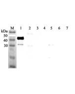 Western blot analysis using anti-ANGPTL7 (human), pAb (Prod. No. AG-25A-0050) at 1:2'000 dilution.<br />
1: Human ANGPTL7 (FLAG<sup>®</sup>-tagged).<br />
2: Human ANGPTL3 (FLAG<sup>®</sup>-tagged).<br />
3: Human ANGPTL6 (FLAG<sup>®</sup>-tagged).<br />
