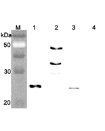 Western blot analysis of human FGF21 using anti-FGF-21 (human), pAb (Prod. No. AG-25A-0074) at 1:4,000 dilution..<br /> 1. Recombinant human FGF21 (FLAG-tagged).<br /> 2. Recombinant human FGF21 (Fc protein).<br /> 3. Recombinant human FGF21 (His-tagged).