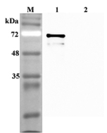 Western blot analysis using anti-Sirtuin 1 (human), pAb (Prod. No. AG-25A-0082) at 1:4'000 dilution.<br />
1: Human Sirtuin 1 (His-tagged).<br />
2: Human FTO (His-tagged) (negative control).