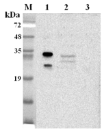 Western blot analysis using anti-NQO1 (human), pAb (Prod. No. AG-25A-0105) at 1:2'000 dilution.<br />
1: Human NQO1 (His-tagged).<br />
2: HepG2 cell lysate.<br />
3: Unrelated protein (His-tagged) (negative control).