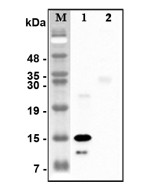 Western blot analysis of recombinant human CTRPs using anti-CTRP5 (human), pAb (Prod. No. AG-25A-0116) at 1:4,000 dilution.<br />1: Recombinant human CTRP5 protein (His-tagged).<br />2: Unrelated recombinant protein (His-tagged).