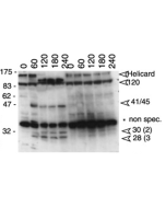 Western blot analysis anti-MDA5 (mouse), pAb (AL180) (Prod. No. AG-25B-0001) detecting the cleavage of endogenous mouse MDA5 as an indicator of apoptosis. <b>Method:</b> Cleavage of endogenous Helicard in murine A20 B lymphomas undergoing Fas-mediated apo