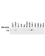 Western blot analysis of human and mouse cell lines using anti-human NLRP1/NALP1 antibody (AL176) (Prod. No. AG-25B-0005).<br /><strong>Method:</strong> Total protein extracts (20&mu;g) from various human (293-T, Jurkat, Raj, Ramos, BJAB, THP-1, U937, K56