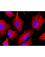 Human alpha-Tubulin is detected by immunocytochemistry using anti-alpha-Tubulin, mAb (rec.) (F2C) (Prod. No. AG-27B-0005).<br /> <b>Method:</b> HeLa cells are grown in standard culture conditions, fixed with methanol, and incubated with anti-alpha-Tubulin