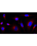 Rab1-GTP is detected by immunocytochemistry using anti-Rab1-GTP, mAb (ROF7) (Prod. No. &nbsp;AG-27B-0006). <br /><strong>Method:</strong> HeLa cells are grown in standard culture conditions, fixed with paraformaldehyde (3%), permeablized in  PBS+ BSA 0.2 