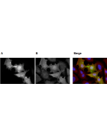 Palmitoylated PSD95 is detected by immunocytochemistry using anti-PSD-95 (palmitoylated), mAb (rec.) (PF11) (Prod. No AG-27B-0021).<br /> <b>Method:</b> HeLa cells were cotransfected with DHHC2 (palmitoylating enzyme) + PSD95-GFP (A) or DHHC2 (palmitoylat