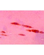 Immunohistochemical staining of MDA-modified protein in atherosclerotic aorta using anti-MDA, mAb (1F83).