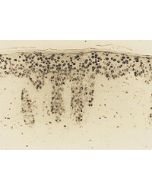 Immunohistochemical staining of epidermis from hairless mouse by chronic UVB irradiation after 4 weeks of treatment using anti-8-OHdG, mAb (N45.1).