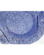 Immunohistochemistry of Human Tonsil Tissue using Anti-Human IgA2 antibody RM125.