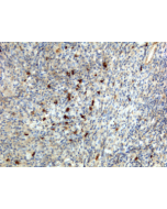 Immunohistochemistry of Human Lymphoid Tissue using anti-Human IgA antibody RM128.