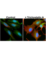 Immunocytochemistry of HeLa cells non-treated or treated with Trichostatin A (TSA), using anti-Acetyl- alpha-Tubulin (Lys40) rabbit monoclonal antibody (Clone RM318) at a 1:5000 dilution (red). Actin filaments have been labeled with fluorescein phalloidin