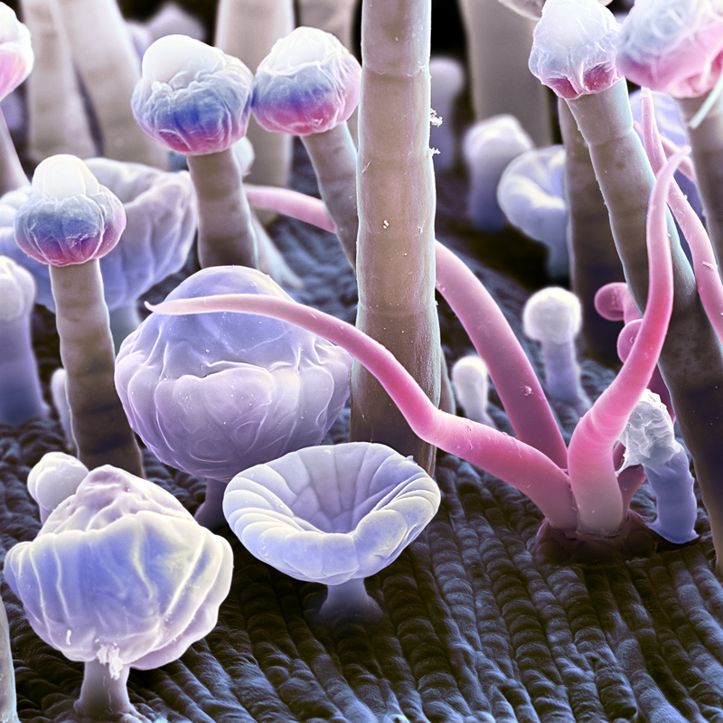 Walnut stem. Delicate trichomes on the surface of a walnut stem resemble jellyfish drifting through a coral reef. Glands contain essential oil.